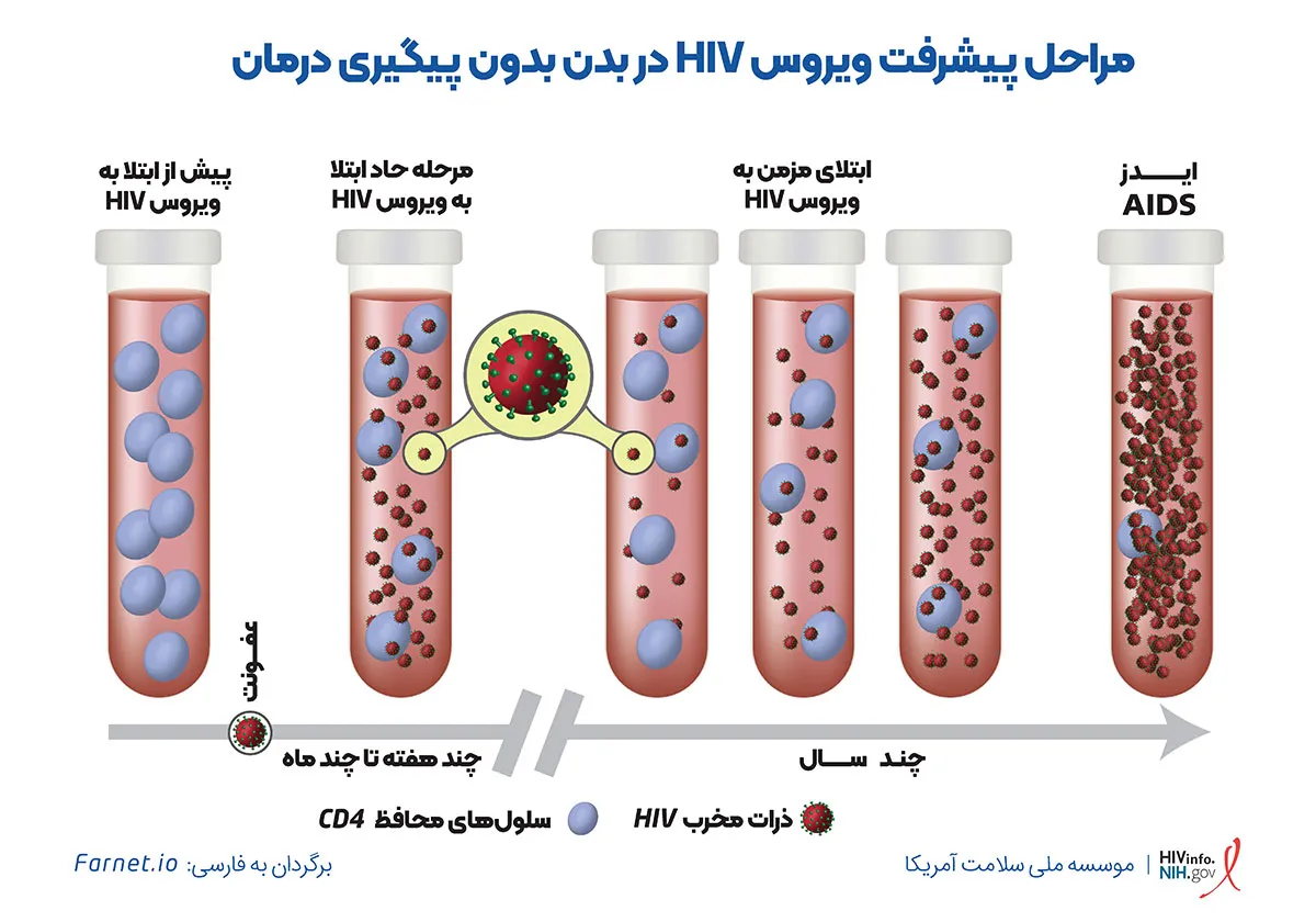 مراحل رشد ویروس HIV و پیشرفت بیماری ایدز در بدن انسان