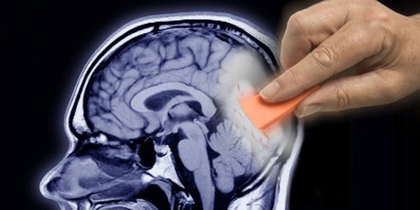 بازیابی حافظه از دست رفته